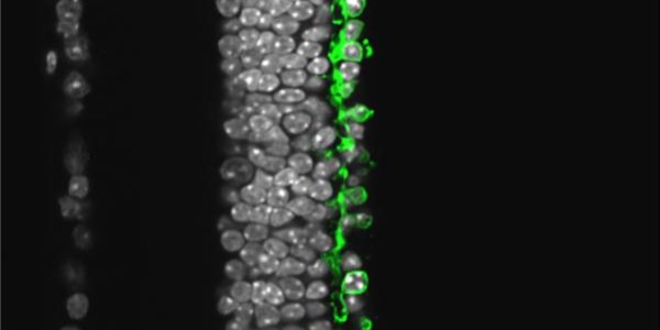 Halorhodopsin - Microbial Protein Restores Vision In Blind Animals