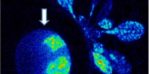 Wound Signals In Plants - Feeding Caterpillars Make Leaves Shine