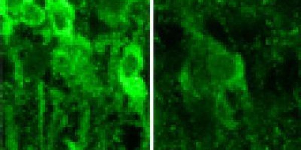 Binge Drinking And The Biology Of Blackouts