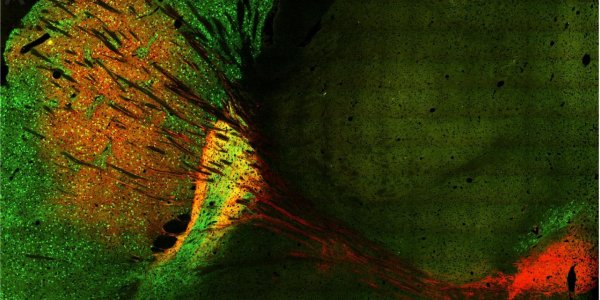 Dark Neural Patches In The Neostriatum