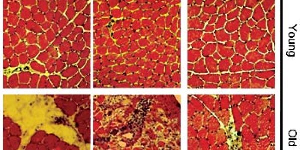 Why Do Our Muscles Age? Muscle Regeneration Gets A Boost