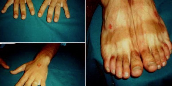 CRUCIFIXION (Stigmata)