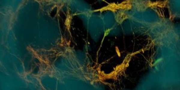 Functional 3-D Brain-Like Tissue Created!