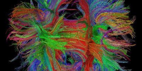 Pruning Brain Connections May Explain Why Girls Seem To Mature Faster