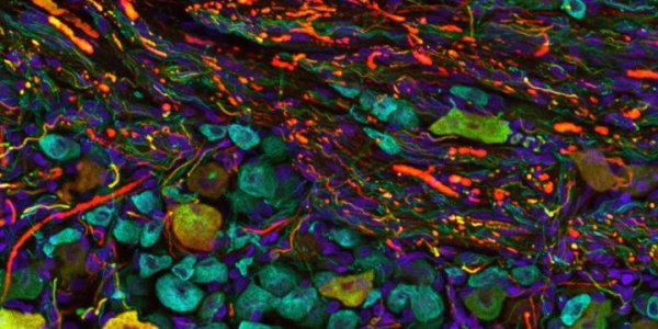 Want Better Aircraft? Ask A Bat About The Sensory Receptors In Their Wings