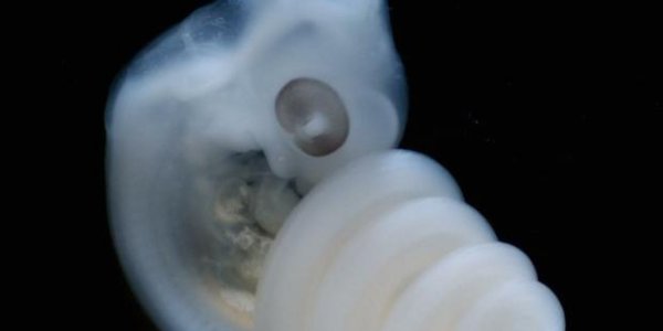 Location, Location, Location: A Real Estate Axiom For The Genesis Of Genitalia