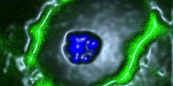 Fructose Block Prevents Fatty Liver Disease In Mice