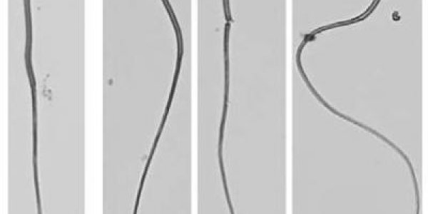 Male Infertility: It's All About The Package