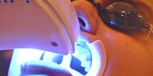 UV Tooth Bleaching Dangerous And No Better For Your Teeth