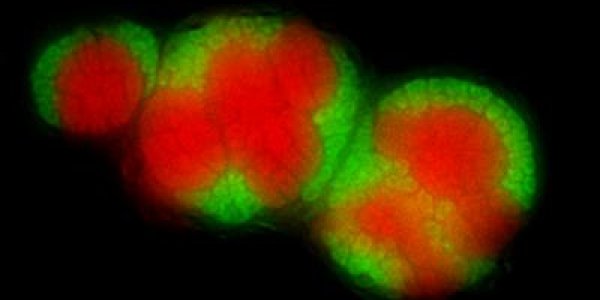 Methane Munching Microorganisms Captured - May Be Key To Mitigating Greenhouse Gases