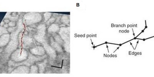 Mapping The Brain, With The Help Of Many
