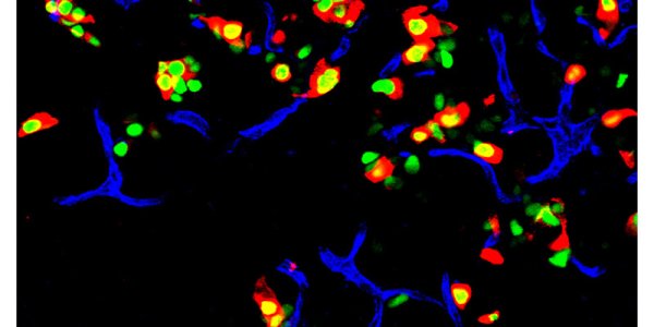 Extreme Makeover: Cell Edition