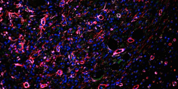 Improved Injectable Scaffold: Hydrogels Deliver On Blood-vessel Growth
