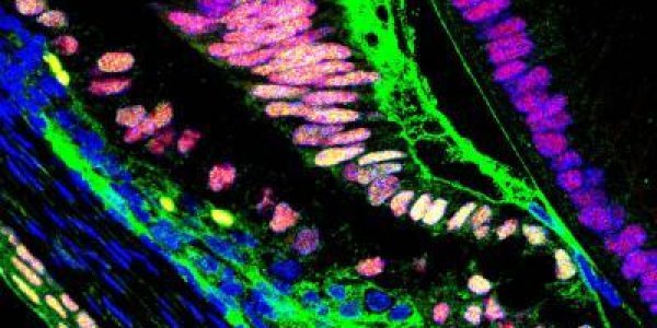 Crosstalk Between Notch And Bone Morphogenetic Protein Signaling Pathways