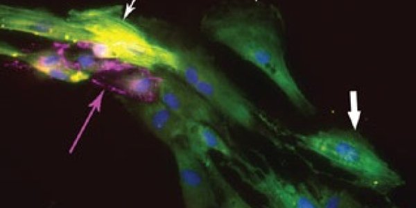 Growing Human Heart Tissue from Embryonic Stem Cells