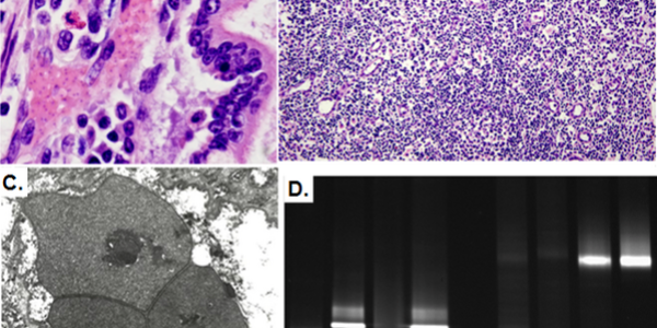 Warming A 'Perfect Storm' For Infectious Diseases, Says Study