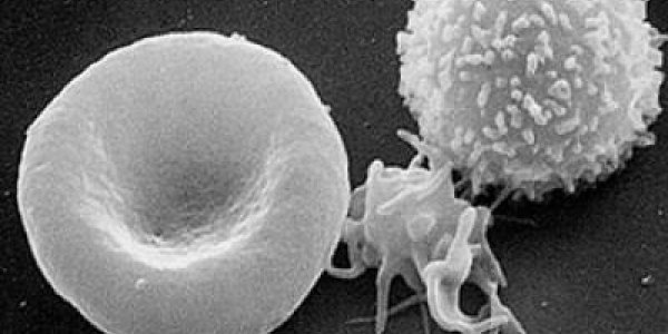 Notch Signaling And New Blood: Tracing The Beginnings Of Hematopoietic Stem Cells