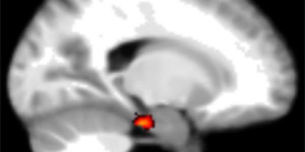 Why Some People Are Better Navigators: Brain's 'Homing' Signal Identified