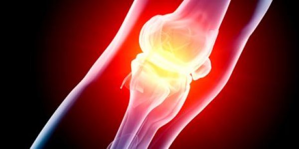 World Of 2015: Cure For Arthritis May Go Into Clinical Trials Next Year