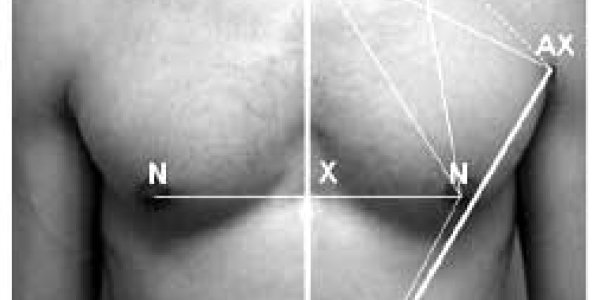 Male Nipple Repositioning And The Golden Ratio