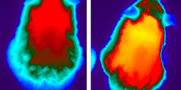 High-Fat Diet And Natural Hormone May Alleviate Mitochondrial Disease