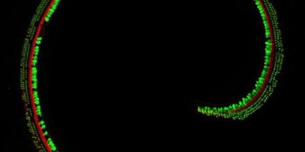 Gene Therapy Restores Hearing In Deaf Mice