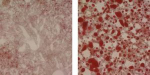 Researchers Discover Master Metabolism Regulator