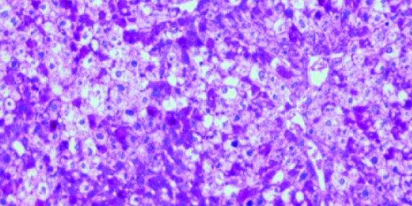 Liver, Brain Communicate In Order To Regulate Appetite