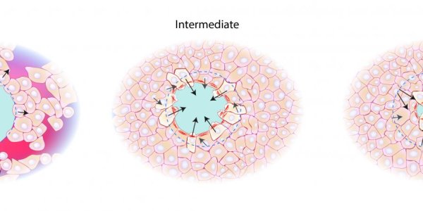 Skin Wounds: How Epithelial Cell Sheets Force Them To Close