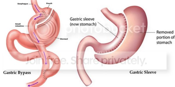 Is Diabetes A Surgical Condition?