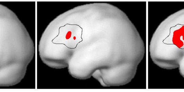 New Look At How The Brain Produces Language