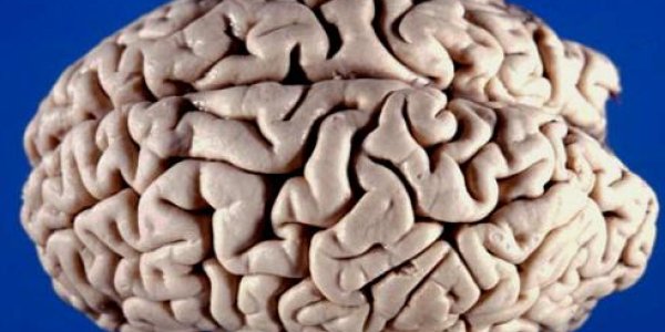 The fuzzy science of “brain training”