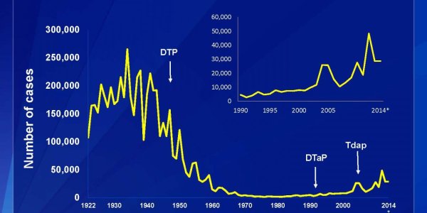Why A Small Drop In Whooping Cough Vaccines Leads To A Case Upsurge