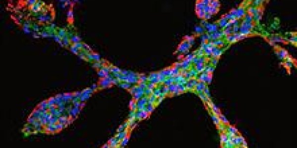 Mini-breast Grown In Petri Dishes