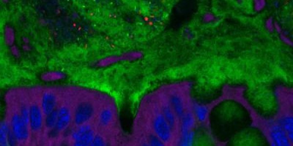 Emulsifiers Promote Obesity And Colitis In Mice