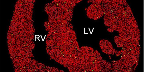 Mammalian Heart Regenerative Capacity Depends On Severity Of Injury