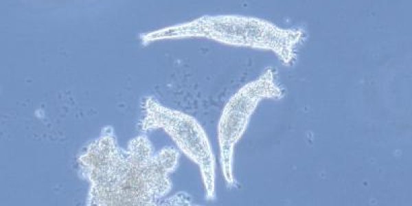 How Bdelloid Rotifers Resist Extinction - DNA Repair And No Sex