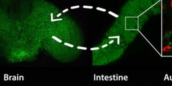 Biologists Delay The Aging Process By 'Remote Control' Of A Gene