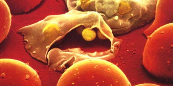 The Race To Cure Malaria