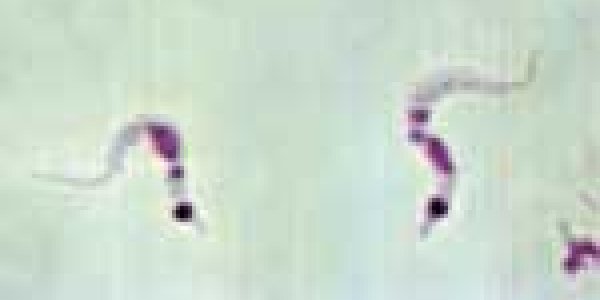 Thanks But No Thanks For AIDS Comparison, Say Chagas Disease Experts