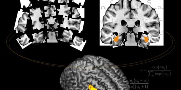 One-Shot Learning: Now With A Switch
