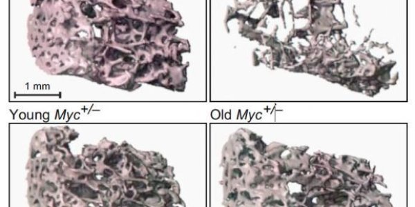 Reducing Myc Gene Activity Extends Healthy Lifespan In Mice