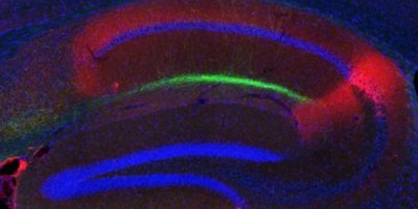 Islands In The Brain: New Circuit Shapes Memory Formation