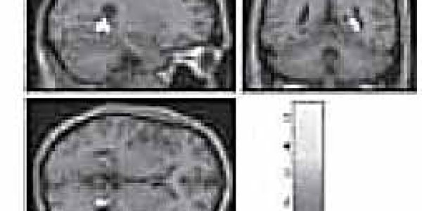 In Search Of 'the Telepathy Center'