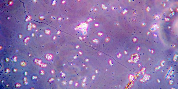 Not Neonics: Parasites Are Bad For Honey Bees