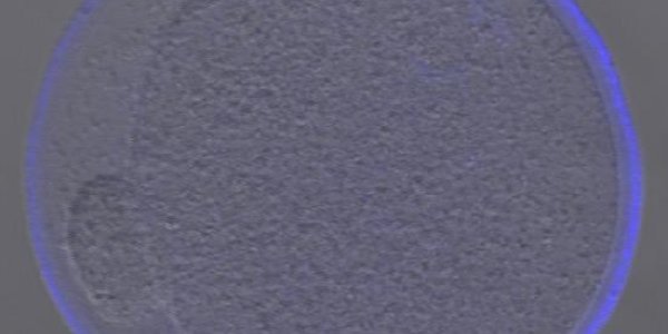 Long Term Contraception In A Single Shot