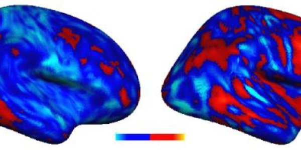 'Idiosyncratic' Brain Patterns In Autism