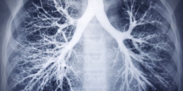 Fixing 'leaky' Blood Vessels To Combat Severe Respiratory Ailments