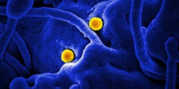 Monkey Model For Severe MERS-CoV Disease May Lead To New Treatment