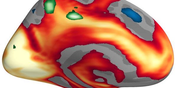 When It Comes To Emotion, Men And Women Process Emotions Differently